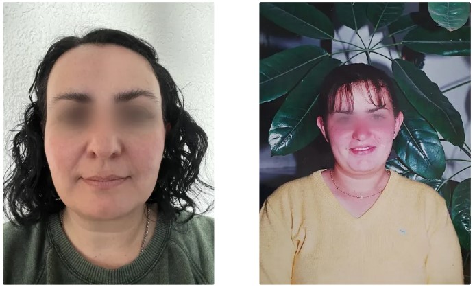 Retratos comparativos de una mujer antes y después de un cambio importante de apariencia.
