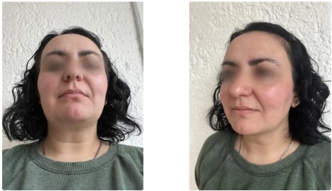 Cuatro fotos de una mujer girando el rostro y cambiando la posición de los ojos para probar la detección de rasgos faciales.