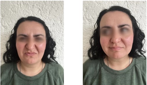 Tres fotos de una mujer haciendo distintas expresiones faciales, incluyendo ceño fruncido, sonrisa y gesto neutral.