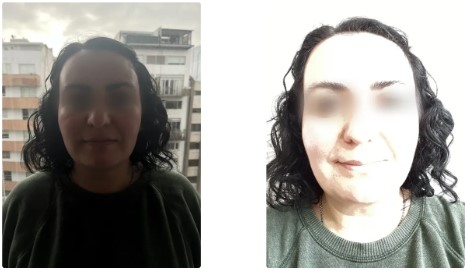 Fotos comparativas del rostro de una mujer bajo sombra intensa y reflejos brillantes.